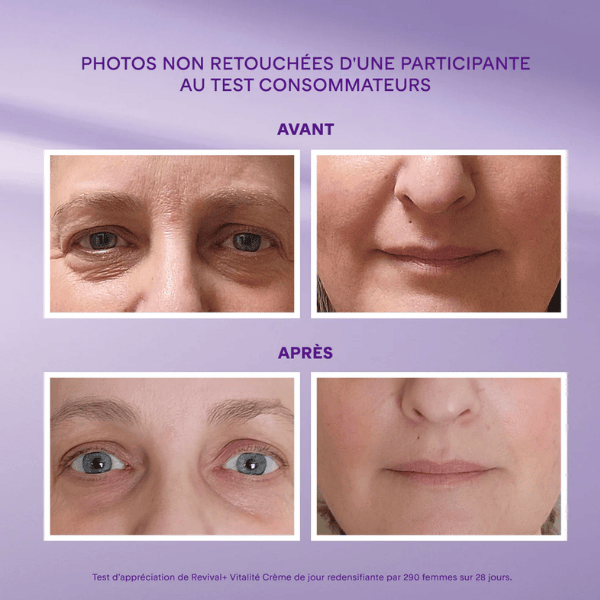 Crème yeux et lèvres redensifiante Revival + Vitalité Ménopause 15 ml